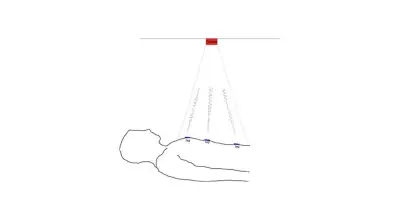 RFID Enables Local Breathing Measurement in Medical Proof of Concept