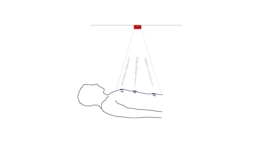 RFID Enables Local Breathing Measurement in Medical Proof of Concept
